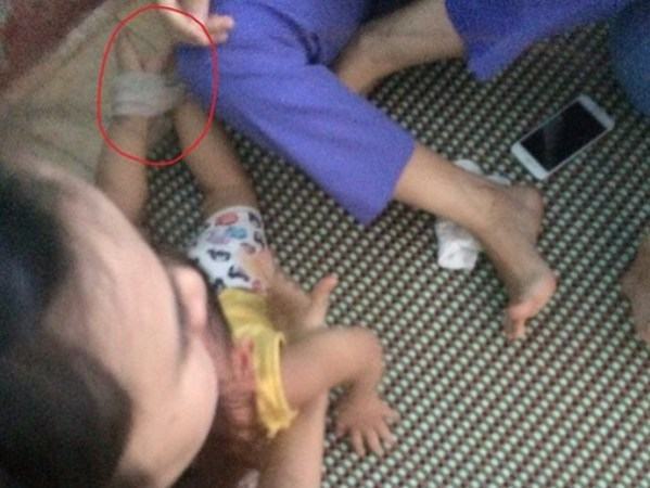 Dừng hoạt động đối với cơ sở mầm non bạo hành trẻ