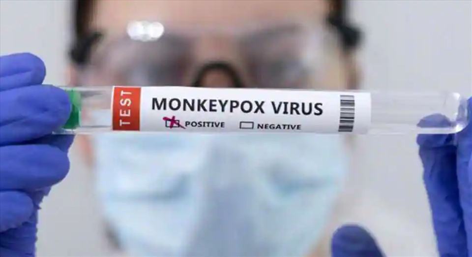 Mỹ tuyên bố đậu mùa khỉ là tình trạng khẩn cấp về y tế cộng đồng