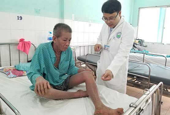 Viêm da cơ địa: Không điều trị đúng cách có thể lan toàn thân