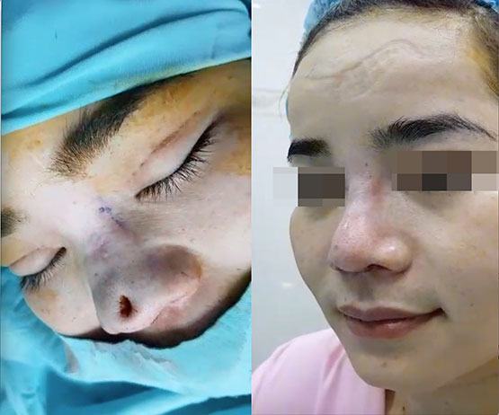 Hỗn loạn thị trường làm đẹp