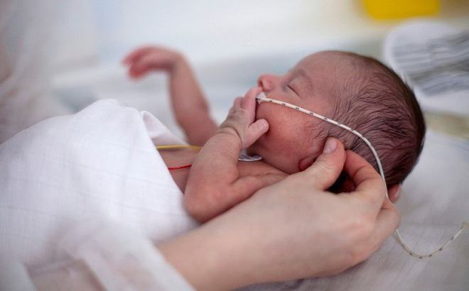 Khoảng 1 triệu trẻ sơ sinh sinh non tử vong/năm