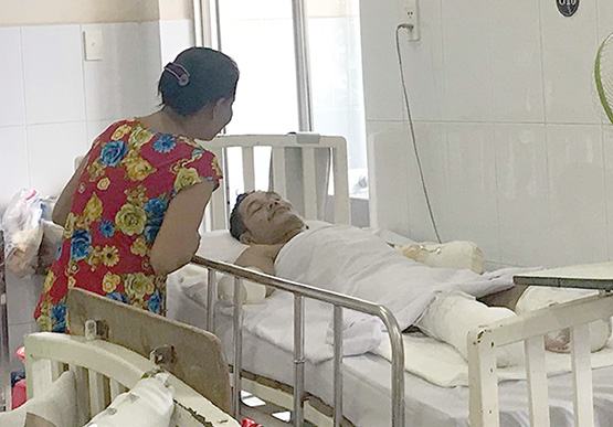 2 bệnh nhân phỏng điện phải cắt cụt tứ chi