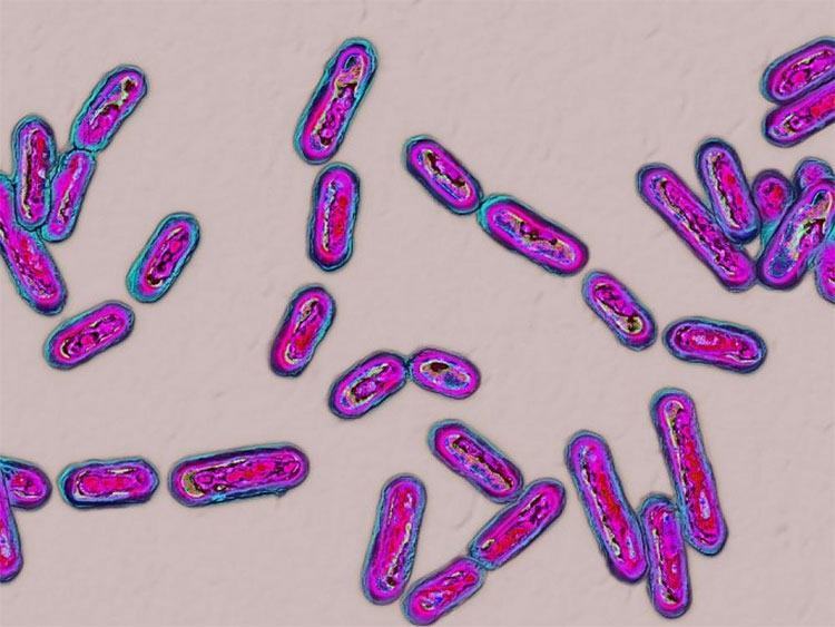 Loài trực khuẩn Clostridium difficile, chụp qua kính hiển vi.