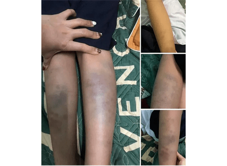 Đà Nẵng: Tăng cường giám sát để ngăn chặn bạo lực học đường