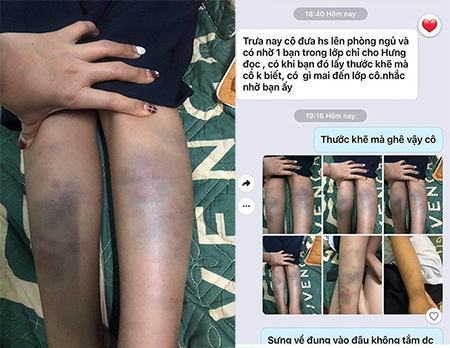 Một học sinh bị đánh tại trường học