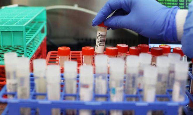 Thêm một biến chủng Covid-19 mới được phát hiện ở Anh /// Reuters