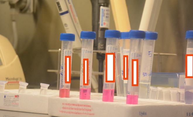 Mẫu xét nghiệm Covid-19 /// Ảnh: Duy Tính