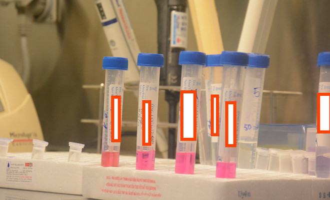 Bệnh nhân Covid-19 người Anh khỏi bệnh rồi lại dương tính đã tiếp xúc 50 người