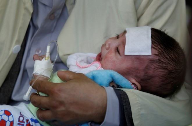 Bệnh sởi tái tăng do tiêm chủng chưa đều