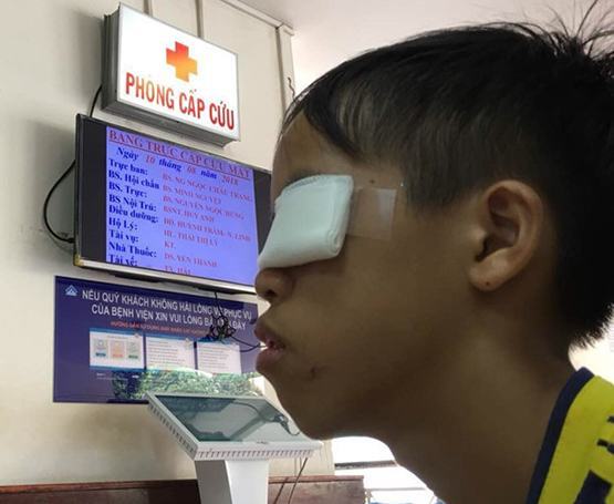 Bệnh nhi 13 tuổi bị vỡ nhãn cầu do pháo tự chế