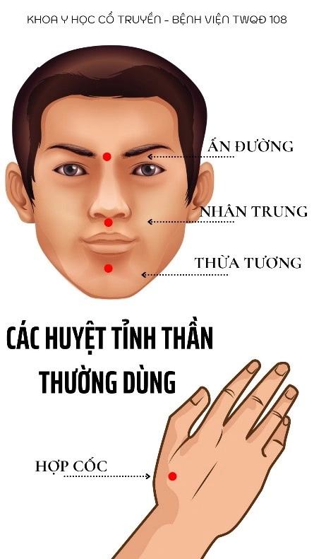 Các huyệt có thể sơ cứu cho người say nắng, say nóng.