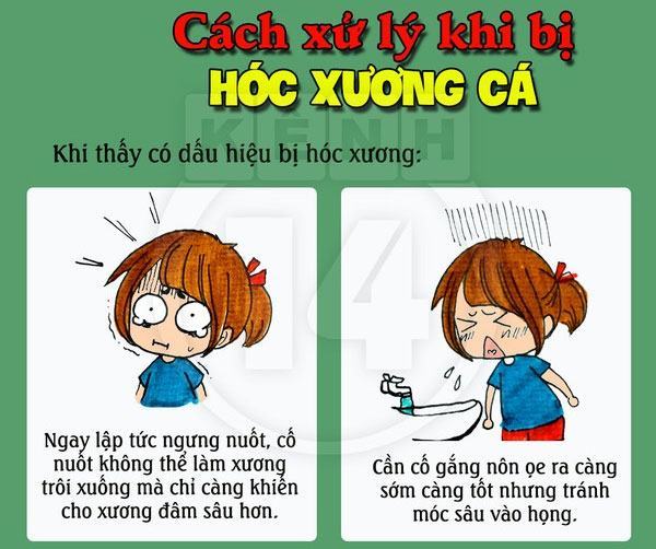 Cách xử lý "chuẩn không cần chỉnh" khi bị hóc xương cá