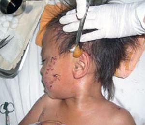 Cảnh giác với “cún cưng”