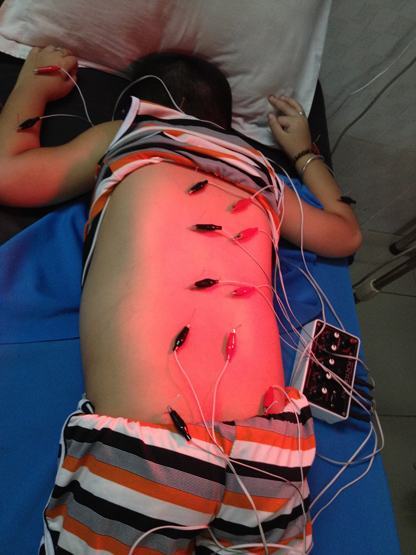 Chữa tự kỷ bằng châm cứu