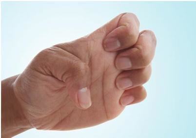 Chữa bệnh tê tay cho dân văn phòng