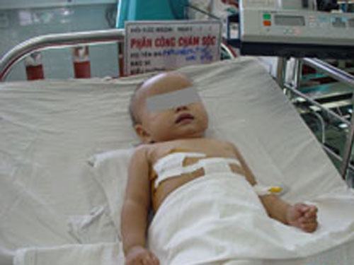 Cứu sống bé gái bị xe cán ngang người