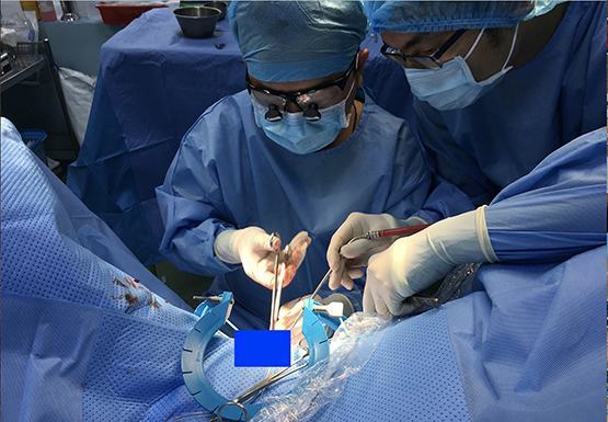 “Bỏ quên” cuộn dây cước 11 năm trong niệu đạo