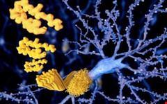 Giảm cân quá mức dễ bị mất trí nhớ