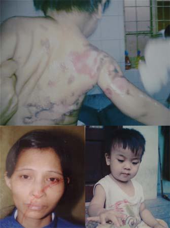 Hà Nội: Tạm giam người đàn bà tạt nước sôi cháu bé 22 tháng tuổi