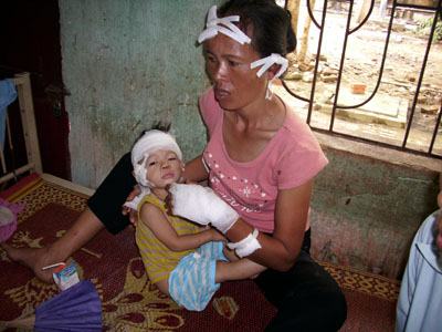 Hà Tĩnh: Đối tượng tâm thần vô cớ chém trọng thương 7 người