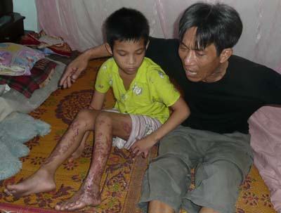 Hà Tĩnh: Khởi tố thêm hai đồng phạm trong vụ thiêu đốt cháu bé 11 tuổi