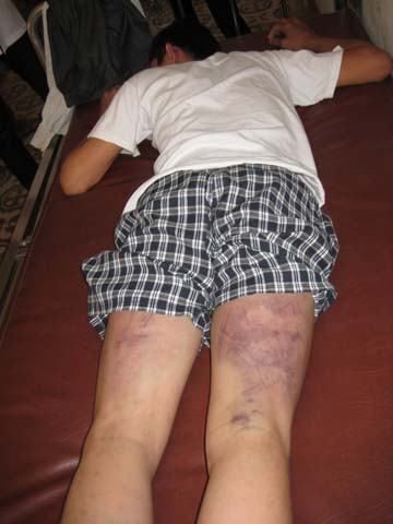 Hà Tĩnh: Trưởng công an xã dùng “nghiệp vụ đặc biệt” để tra khảo dân