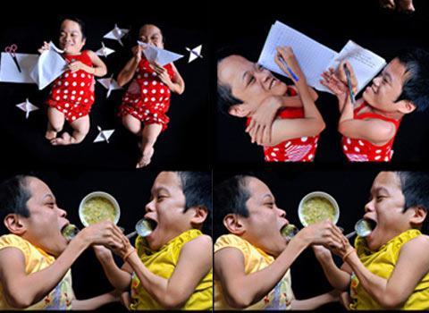 Hai chị em gần 30 năm chưa biết ngồi