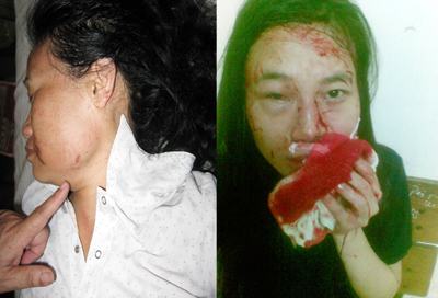 Hài Phòng: Tranh chấp lối đi chung, cả nhà bị đánh trọng thương