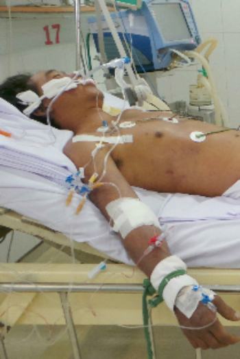 Đừng để chết vì nhiễm liên cầu lợn