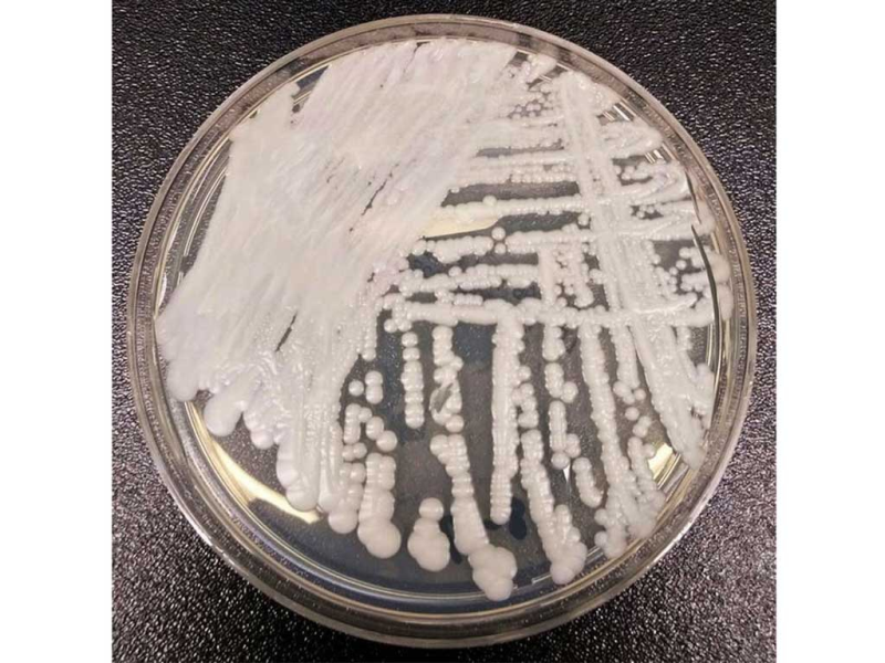 Loại nấm siêu kháng thuốc mới được cho là vẫn đang lây lan và đã làm 3 người tử vong tại Mỹ /// CHICAGO TRIBUNE