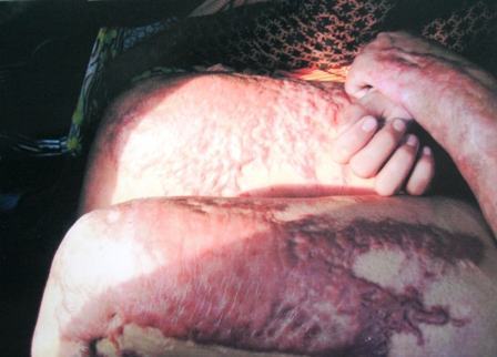 Long An: Dấu hiệu “chìm xuồng” vụ bé gái 13 tuổi bị hãm hại dã man