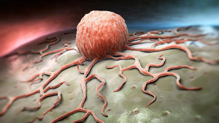 Sự hợp tác giữa các nhà sinh vật học và chuyên gia máy tính là chìa khoá để giải quyết ung thư.