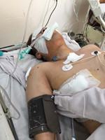 Một thanh niên bị bắn trước cửa nhà: Bị thủng phổi, mất 2 lít máu