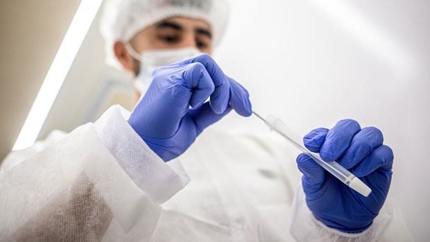 Nga phat trien bo xet nghiem co the phat hien ngay bien the Omicron hinh anh 1