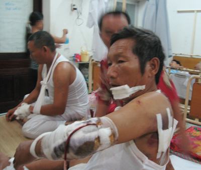 Nghệ An: 10 côn đồ chém 4 người cùng gia đình trọng thương