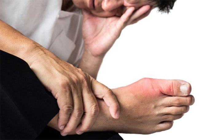 Nguyên nhân bất ngờ khiến nhiều người dễ bị bệnh gout