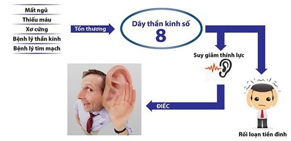 Dây thần kinh số 8 quyết định khả năng nghe của bạn.