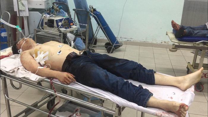 Nhóm trộm xe SH đâm chết 2 hiệp sĩ, 3 hiệp sĩ bị thương - Ảnh 3.