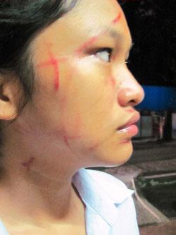 Nữ sinh xích mích, phụ huynh “xuống tay”