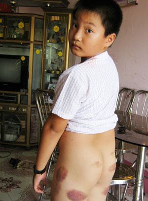 Phạt người cậu đánh cháu 1 triệu đồng