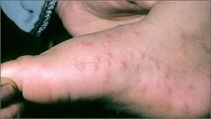 Phòng chống dịch bệnh tay chân miệng tại trường học