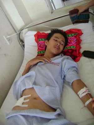 Quảng Nam: Can bạn đánh nhau, học sinh lớp 12 bị đâm vào bụng