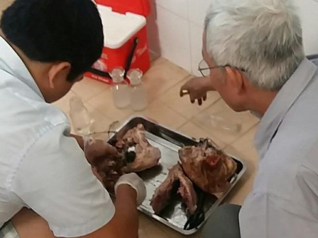 Phát hiện ổ bệnh sán dây lợn trên người