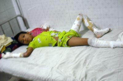 Sẽ khởi tố vụ án đốt cháu bé 11 tuổi