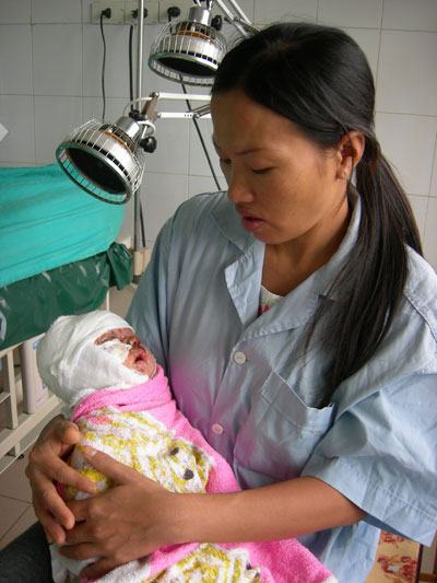 Sưởi ấm, bé trai 1 tháng tuổi rơi vào chậu than