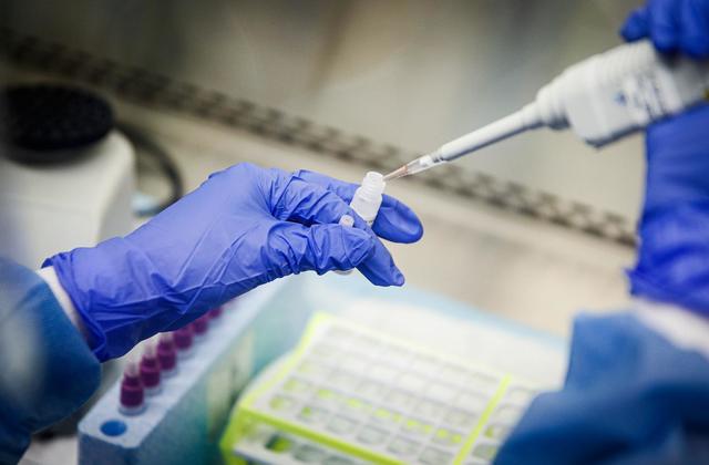 Thêm biến thể SARS-CoV-2 mới ở Mỹ, có khả năng vô hiệu hóa một số vắc-xin hiện có