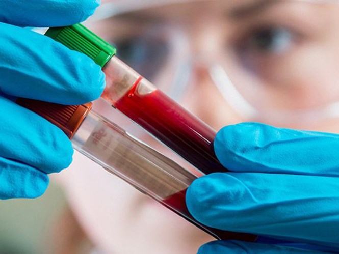 Thử máu lúc chẩn đoán ung thư phổi giúp điều trị nhanh hơn