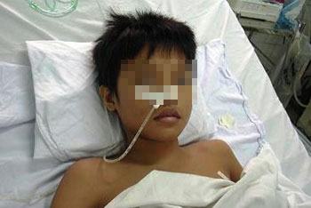 TPHCM: Bé trai 14 tuổi bị đâm thủng màng phổi trái