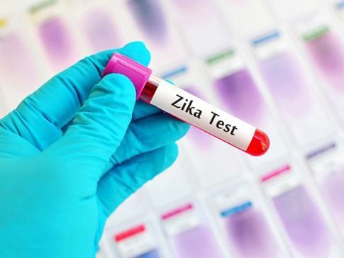 Trẻ bị dị tật đầu nhỏ do Zika, gánh nặng chăm sóc thế nào? - ảnh 2