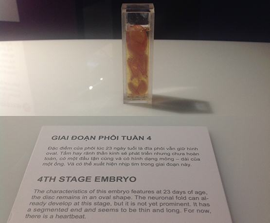 Khi nghệ thuật gây… tranh cãi